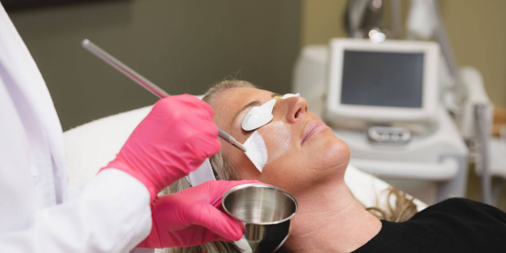 chemical peel for pigmentation