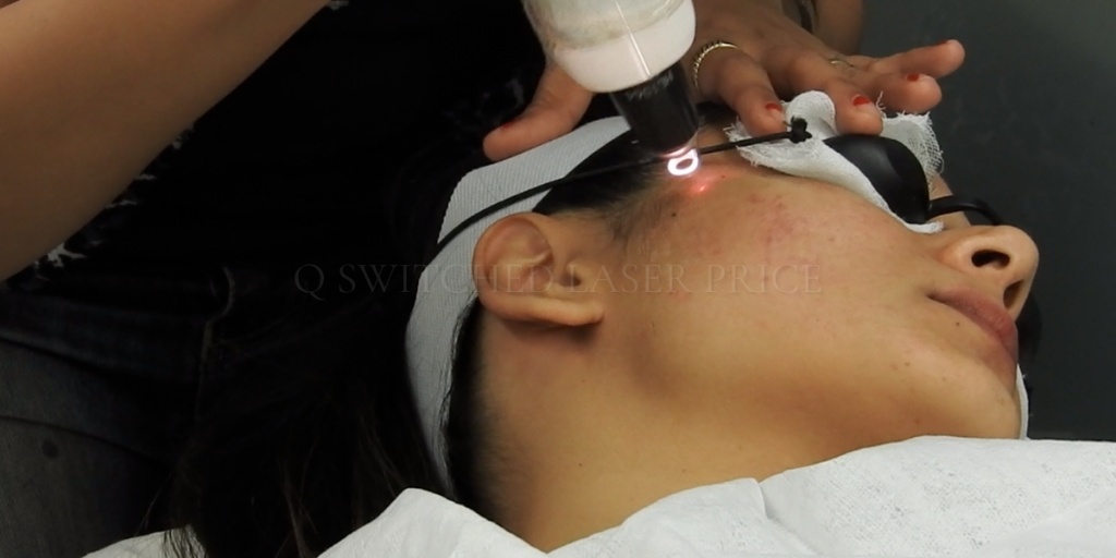 Q Switched Laser Price