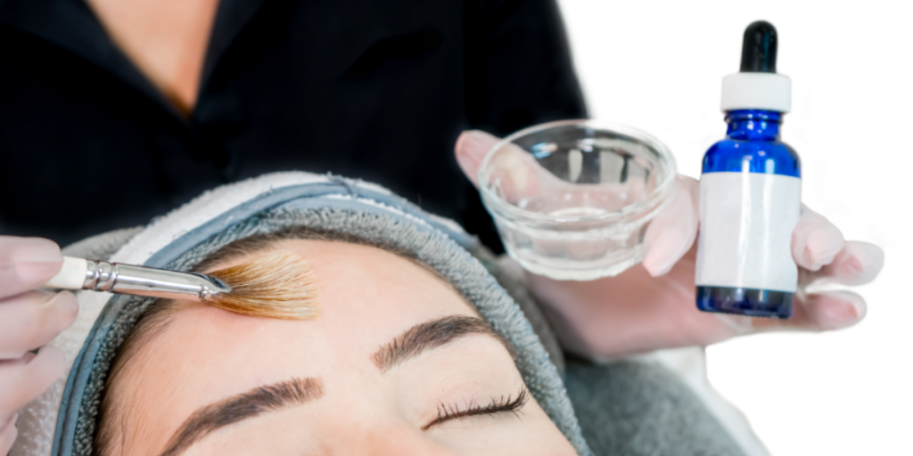chemical peel for dark spots