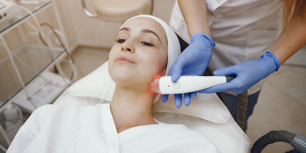 chemical peel for hyperpigmentation