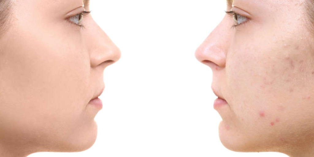 dermatologist treatment for dark spots on face