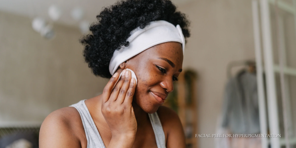 facial peel for hyperpigmentation