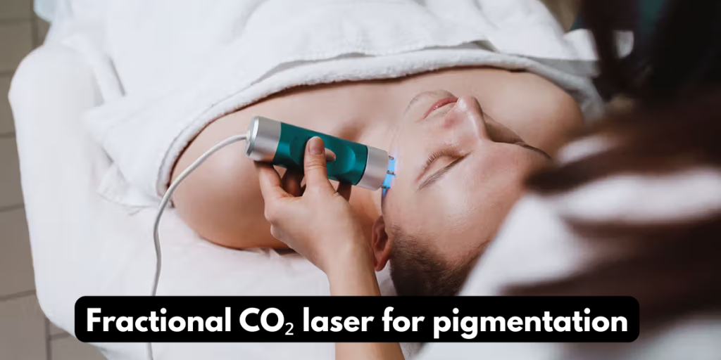 Fractional CO₂ laser for pigmentation