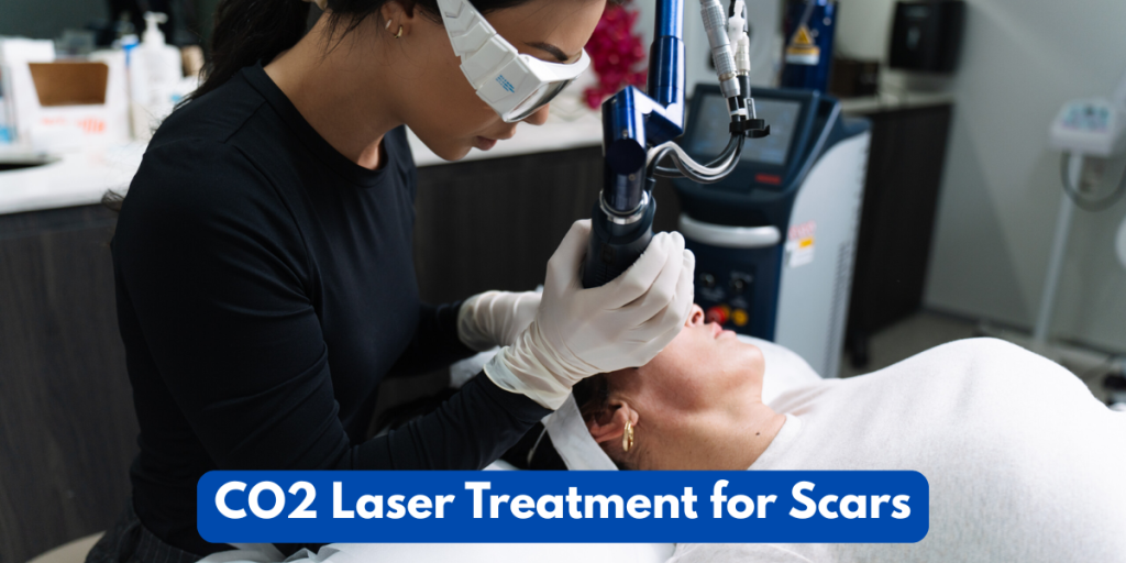co2 laser treatment for scars