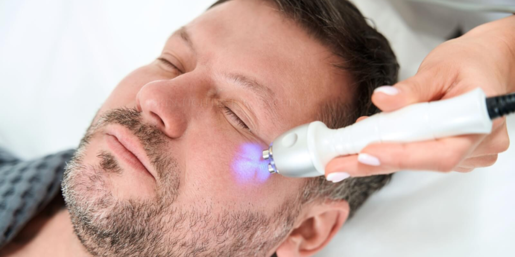 skin tightening machine