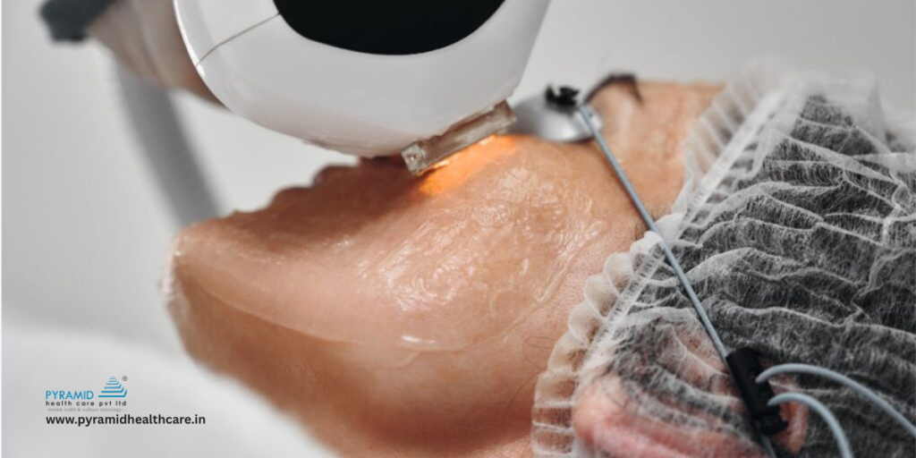 co2 laser for surgical scars
