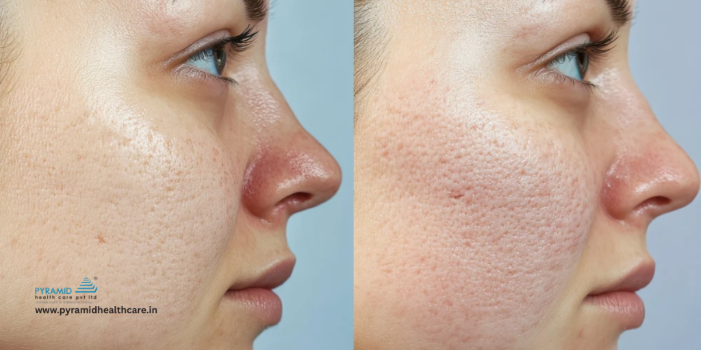co2 laser treatment for scars