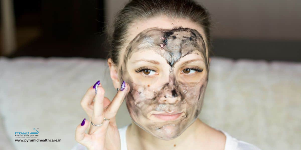 facial peel for hyperpigmentation