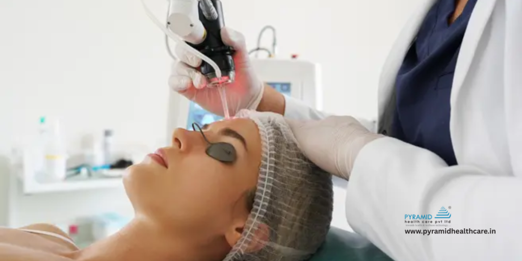 laser for pigmentation