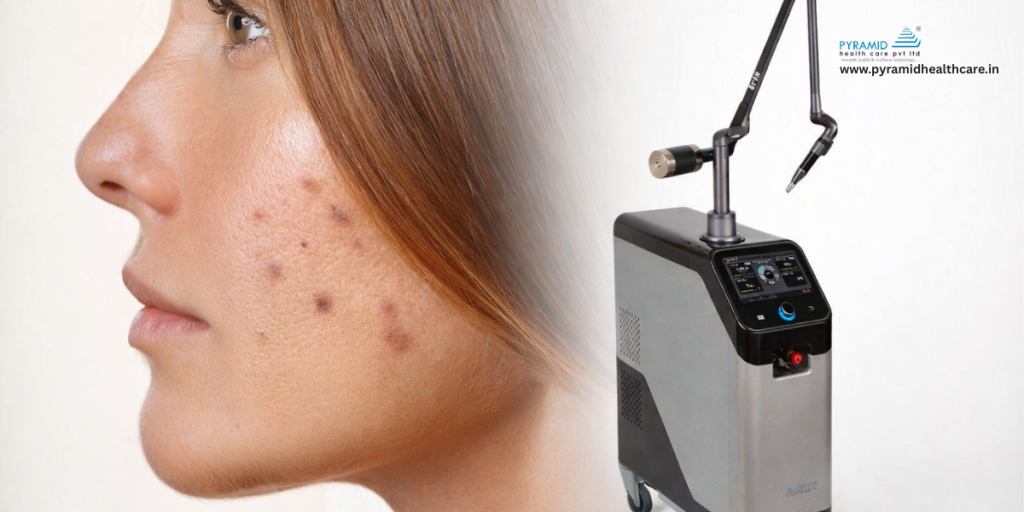 fractional co2 laser machine